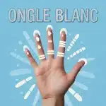 main avec ongle blanche et taches