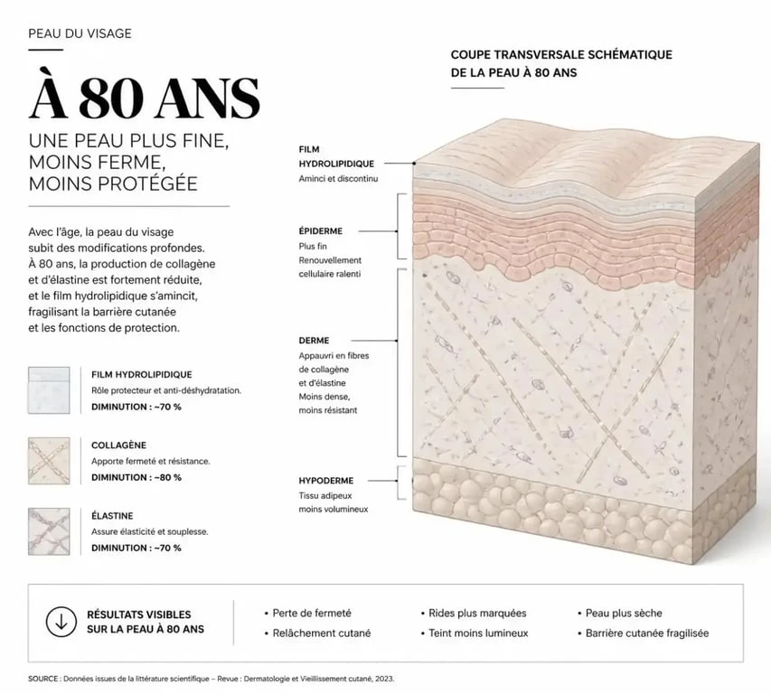 Schéma de la peau et crème visage femme 80 ans montrant la perte de collagène et d'hydratation